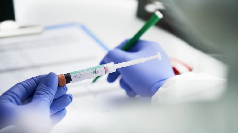 ICMR issues fresh advisory on COVID-19 testing ICMR issues fresh advisory on COVID-19 testing